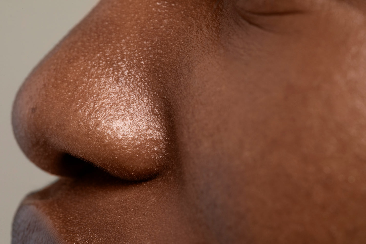 Clogged Pores on Nose: What Causes Them and How to Clear Them for Good