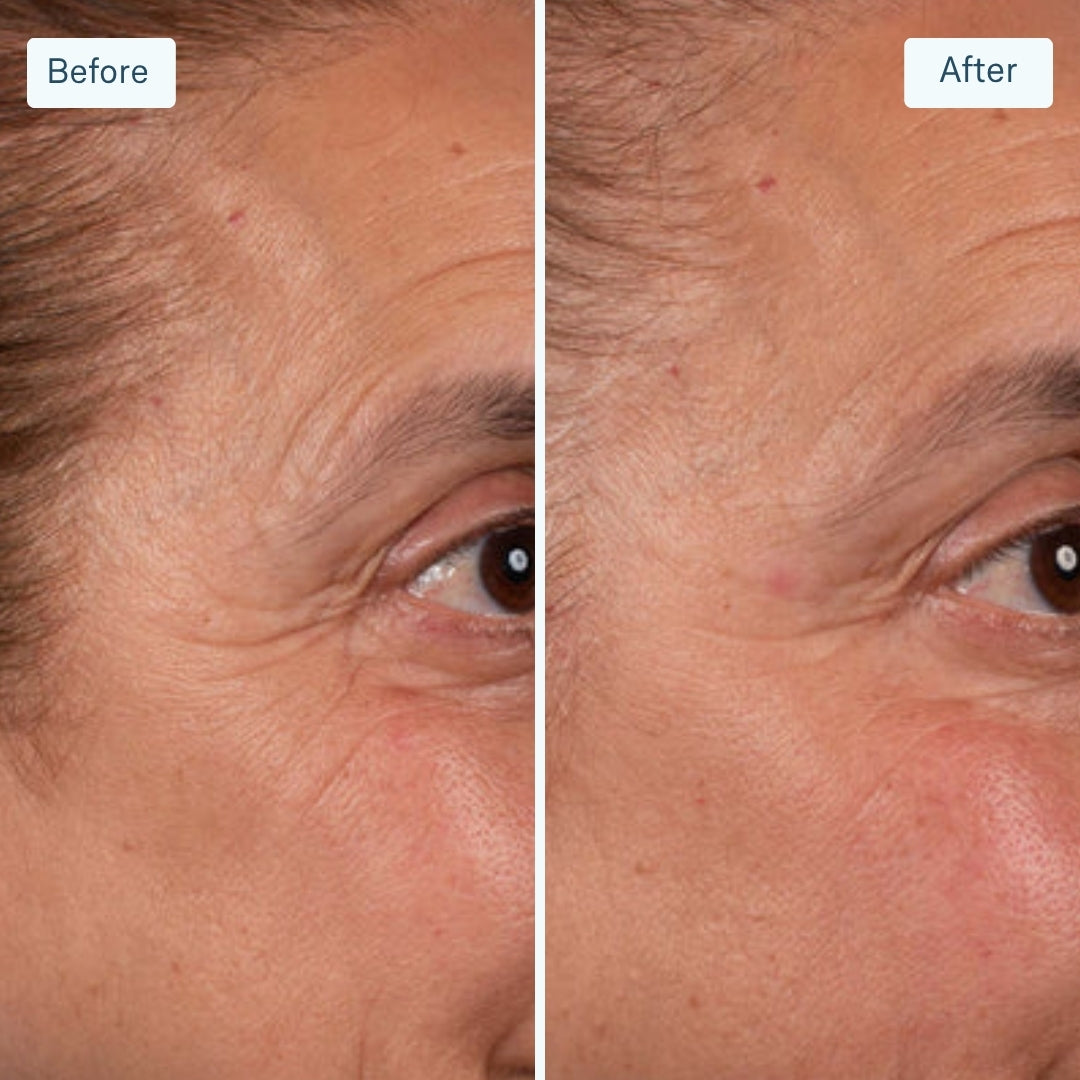 LuminX Pro LED Face Mask Light Therapy Spa Kit