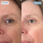LuminX Pro - LED Face, Jawline & Lip Mask