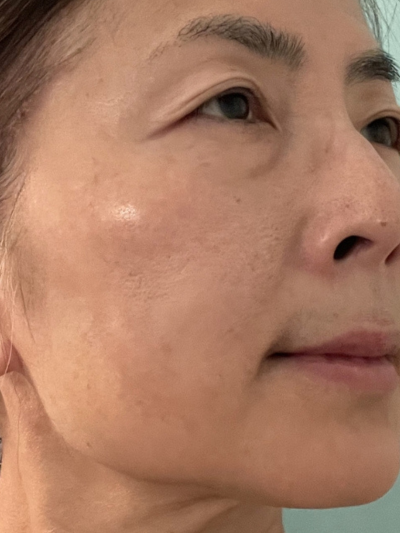 SKIN LUMINOSITY