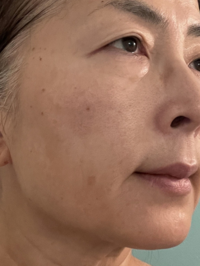 SKIN LUMINOSITY