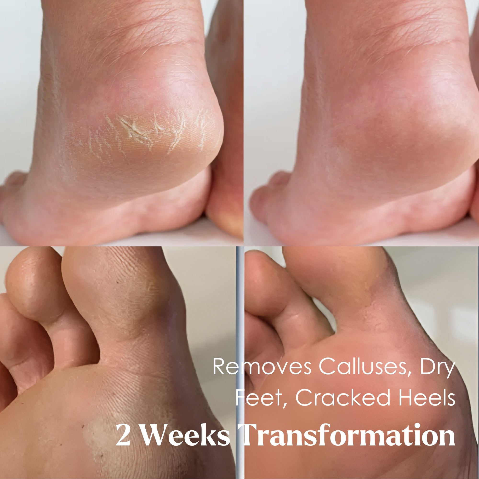 Peel & Care Foot Revival Spa Kit